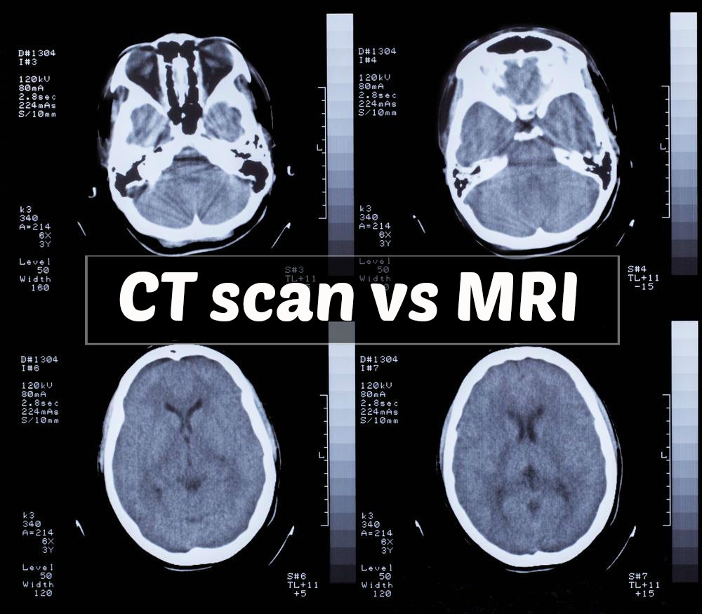 Mri And Ct Scan Comparison And Their Roles In Personal Injury Cases